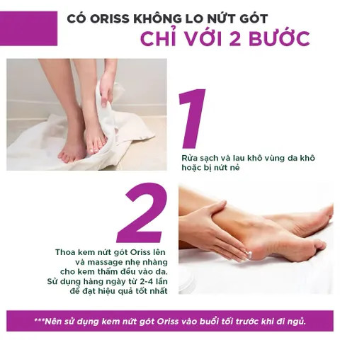Kem nứt gót và dưỡng da chân tay Oriss tinh chất nghệ và trầu không tái tạo làm hồng gót Tuýp 30gr