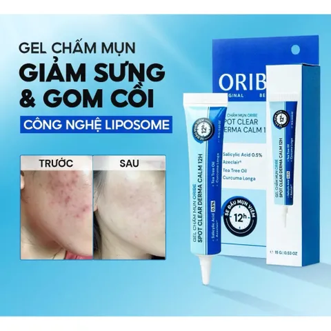 Gel chấm mụn Oribe, giảm mụn nhanh ngừa thâm làm mờ sẹo mụn, khô cồi mụn sau 12H sử dụng