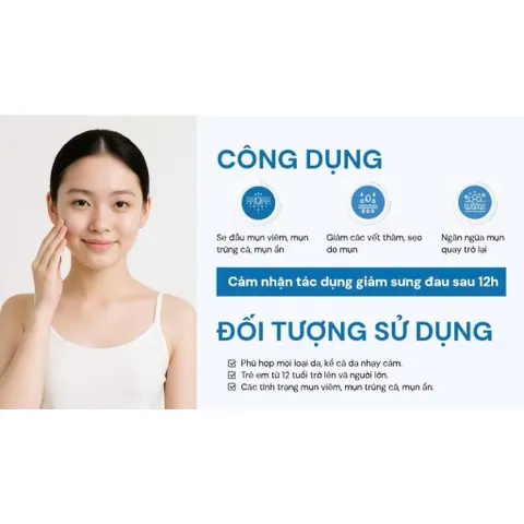 Gel chấm mụn Oribe, giảm mụn nhanh ngừa thâm làm mờ sẹo mụn, khô cồi mụn sau 12H sử dụng