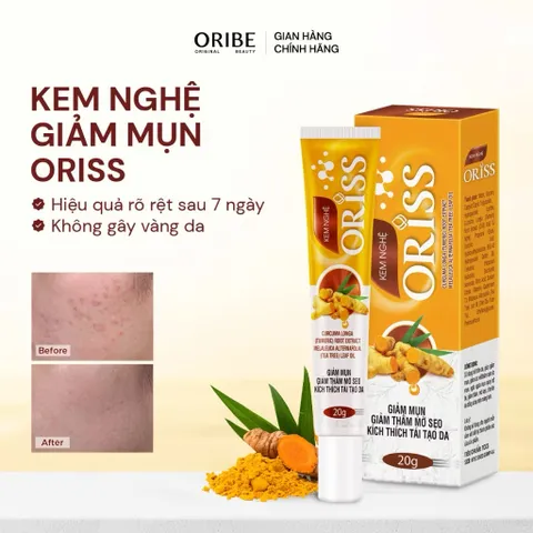 Kem nghệ Oriss giảm mụn và thâm không gây vàng da dành cho da dầu mụn tuýp 20gr