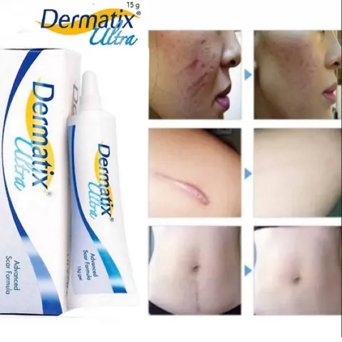 Gel làm mờ sẹo Dermatix Ultra (Tuýp 7g) Giúp làm phẳng và mờ sẹo, thẩm thấu nhanh, không cần mát xa, không nhờn dính.