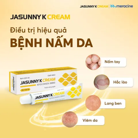 Kem Bôi Da Jasunny K Cream (Tuýp 10g) Hỗ trợ nấm ngoài da: Như hắc lào (lác), nấm bẹn, nấm bàn tay và nấm bàn chân.