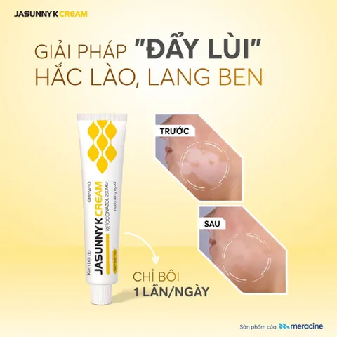 Kem Bôi Da Jasunny K Cream (Tuýp 10g) Hỗ trợ nấm ngoài da: Như hắc lào (lác), nấm bẹn, nấm bàn tay và nấm bàn chân.