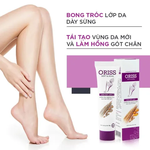Kem nứt gót và dưỡng da chân tay Oriss tinh chất nghệ và trầu không tái tạo làm hồng gót Tuýp 30gr 812730