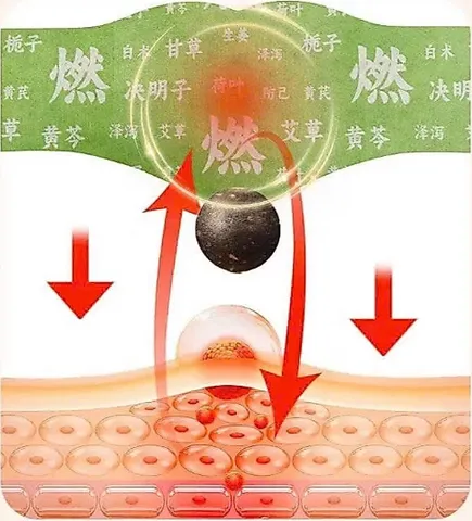 Miếng Dán Ngải Cứu Mỡ Vùng Bụng Giúp Giữ Ấm Hỗ Trợ Thải Độc Tự Nhiên Chăm Sóc Sức Khỏe.