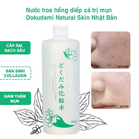 Nước hoa hồng diếp cá giảm mụn Dokudami Natural Skin 500ml Nhật Bản 813625