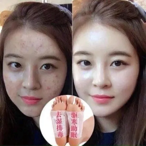 Hộp 50 Miếng Dán Chân Thải Độc Lão Bắc Kinh - Miếng Dán Thải Độc Bàn Chân Ngải Cứu Giúp Ngủ Ngon, Lưu Thông Máu 814398