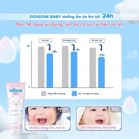 Kem dưỡng ẩm DIZIGONE Baby 30g giảm khô da, nứt nẻ, bong tróc, phục hồi và bảo vệ da cho bé