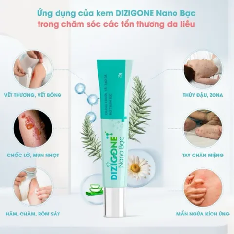 Kem DIZIGONE Nano Bạc - Kem kháng khuẩn, lành thương, tái tạo da, ngăn ngừa sẹo 25g