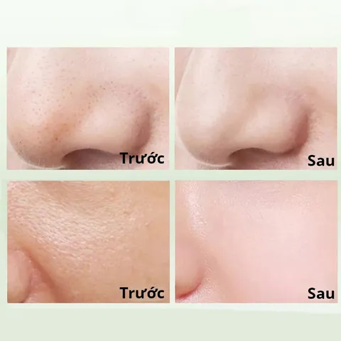 Mặt nạ bùn trà xanh giảm mụn làm sạch da TreeChada Cleansing Mask Thái Lan 100g