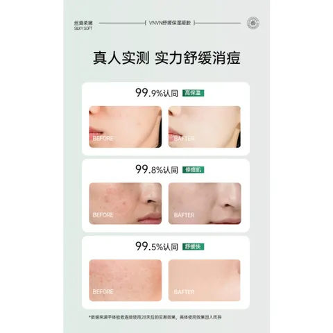 Gel nha đam dưỡng da VNVN Aloe Vera Soothing Moisturizing Gel Thái Lan 300g