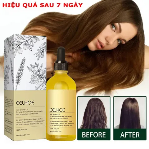 Serum mọc tóc tinh dầu mọc tóc Tinh chất mọc tóc Tinh Chất Chống Rụng Tóc Kích thích tóc mọc nhanh và giảm rụng tóc