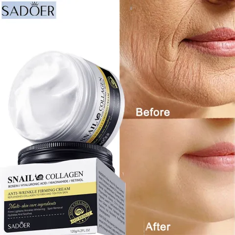 Kem Dưỡng Trắng Ốc Sên 120g Collagen Snail Cream