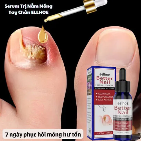 Tinh chất nấm móng Serum Tẩy Nấm Móng Tay Chân Loại Bỏ Nấm Móng Dưỡng Móng Phục Hồi Móng