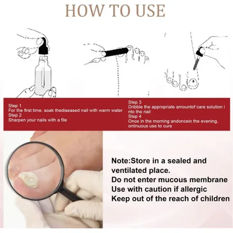 Tinh chất nấm móng Serum Tẩy Nấm Móng Tay Chân Loại Bỏ Nấm Móng Dưỡng Móng Phục Hồi Móng