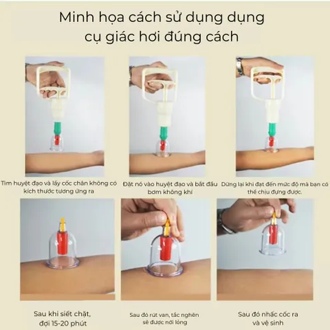 Bộ Giác Hơi Chân Không 32 Ly,24 Ly, 12 Ly Bộ Giác Hơi Không Dùng Lửa Loại Cốc Dày Hàng Cao Cấp
