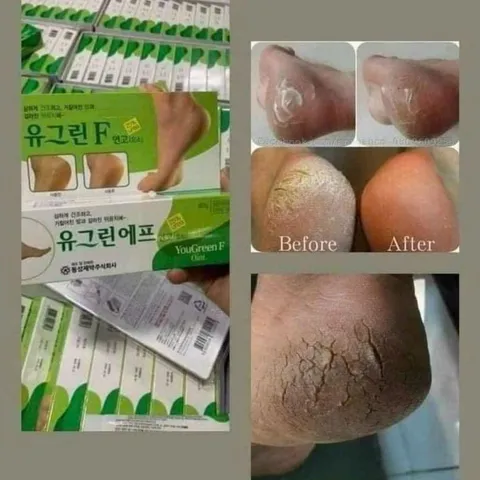 Kem bôi nứt gót chân Hàn Quốc mềm mại dưỡng ẩm