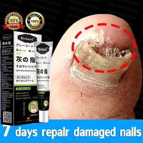 Kem bôi nấm móng tay Nhật Bản 20G