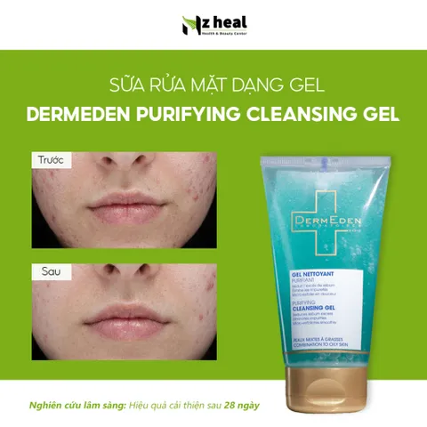 [Hỏa tốc] Sữa rửa mặt DermEden Purifying Cleansing Gel – Làm sạch và kiểm soát bã nhờn cho da dầu mụn (150ml)