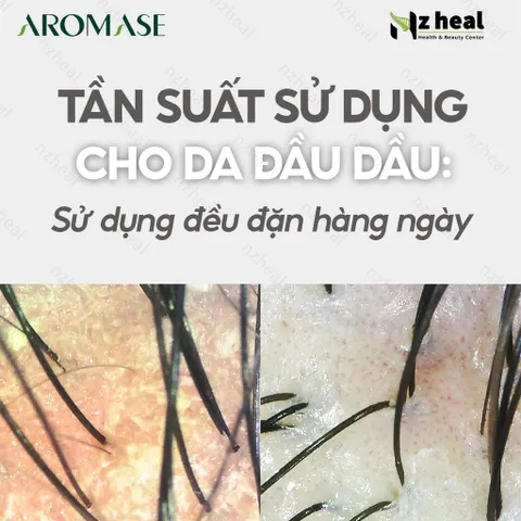 [Hỏa tốc] Dầu gội trị gàu và giảm nhờn da đầu Aromase Oily Scalp Balancing Shampoo 90ml