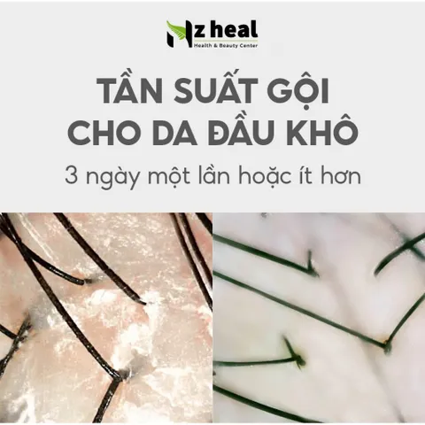 [Hỏa tốc] Dầu gội giảm gàu, giảm ngứa Aromase Dry Scalp Soothing Shampoo (90ml/ 400ml)