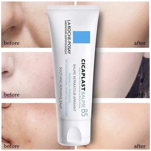 Kem dưỡng phục hồi làm dịu da La Roch Posay Cicaplast Baume B5+ 40ml