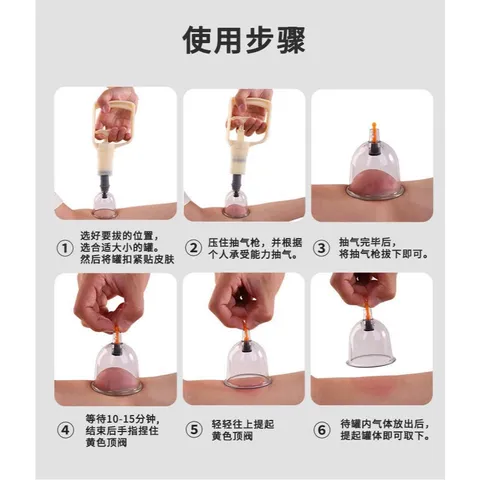 Bộ giác hơi chân không 32 ly - bộ giác hơi không dùng lửa 32 cốc giác. Loại xịn