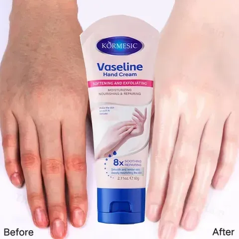 Kem Dưỡng Da Tay Vaseline 60g – Dưỡng Ẩm, Làm Trắng Da, Giúp Da Mịn Màng và Không Nứt Nẻ, Phù Hợp Mọi Loại Da 820799