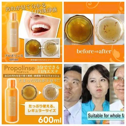 Nước Súc Miệng Nhật Bản Propolinse Vàng 600ml - Giải Pháp Làm Sạch Răng Miệng, Ngăn Ngừa Hôi Miệng, Hương Bạc Hà Tươi Mát 820891