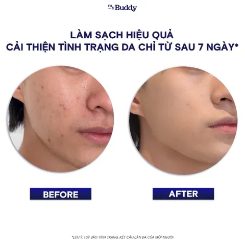 Bột Rửa Mặt Enzymed Chiết Xuất Thiên Nhiên, Sạch Sâu, Ngừa Mụn myBuddy 30g (P134703)