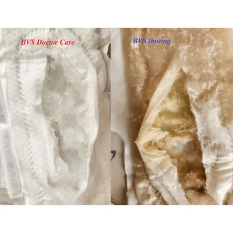[COMBO 5 GÓI] Băng vệ sinh thảo dược DOCTOR CARE ban ngày - hương bạc hà, siêu thấm hút, khô thoáng, an toàn sử dụng