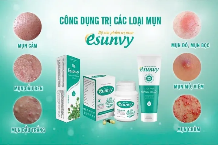 Esunvy t 25g hộp 1 tube ngăn ngừa các loại mụn: mụn trứng cá, mụn viêm, mụn cám, mụn đầu trắng, mụn đầu đen, mụn mủ, mụn bọc.