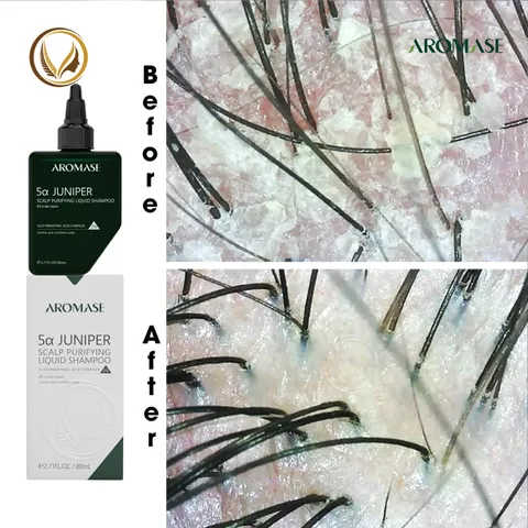 Dầu gội sạch sâu dạng lỏng AROMASE 5α Juniper Scalp Purifying Liquid Shampoo 80ml