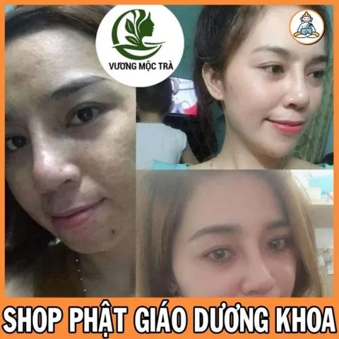 Serum tái tạo da CAO CẤP VƯƠNG MỘC TRÀ chai 30ml chuyên mụn, nám, tàn nhang, sẹo nhanh bong TẶNG BỘT