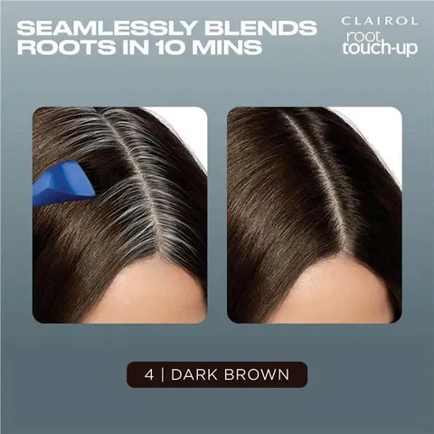 Nhuộm Tóc Chấm Chân Clairol Úc Root Touch Up Permanent Tiện Dụng Tại Nhà