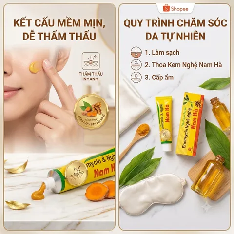 Kem nghệ Nam Hà + nghệ nano bôi hỗ trợ ngừa mụn thâm, mờ sẹo- Được Đồng Kiểm Hàng