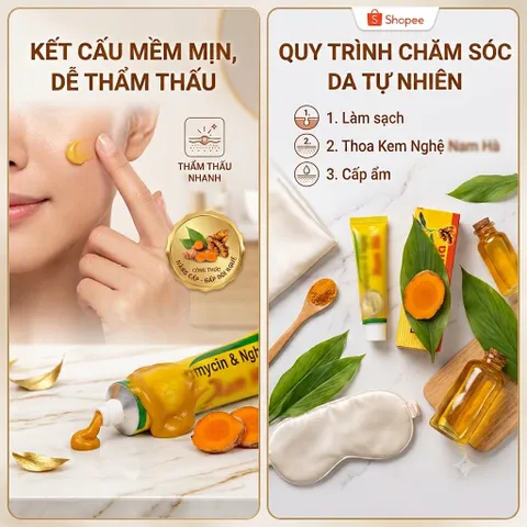 Kem Bôi Nghệ E-r-y-t-h-r-o NH Hỗ Trợ Làm Dịu Vùng Da Thô Ráp & Mịn Bề Mặt Da Tuýp 10g