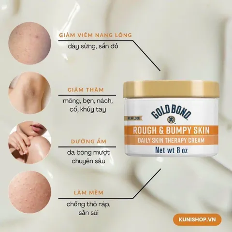 Kem Dưỡng Ẩm Sâu Cho Da Khô Sần Gold Bond Rough & Bumpy Skin 226g Mỹ