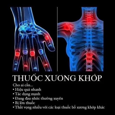 Hàng MỸ Viên tái tạo sụn khớp Cosamin DS 230 viên For Joint Health
