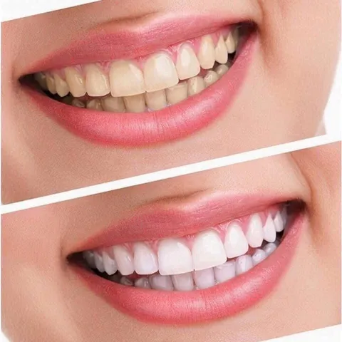 1 tuýp kem đánh răng crest 3d white advanced whitening tuýp 147g crest Mỹ