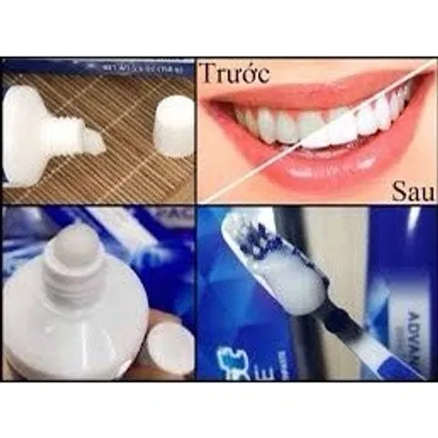 Lốc 5tuýp kem đánh răng Crest 3D White Advanced Triple Whitening 158g Mỹ, trắng răng date 24