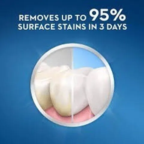 Lốc 5tuýp kem đánh răng Crest 3D White Advanced Triple Whitening 158g Mỹ, trắng răng date 24