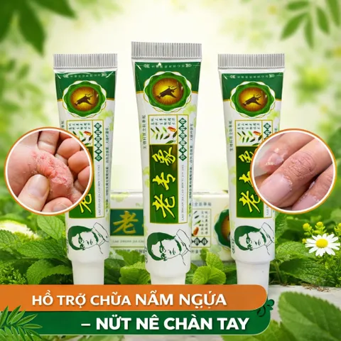 (xanh lá) - Kem bôi da thảo dược – Dưỡng ẩm, mềm da, giảm khô nứt tay chân, các vấn dề về da liễu