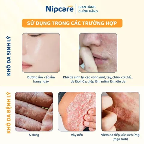 Kem dưỡng ẩm Nipcare Novocare 100g - dưỡng ẩm cho da khô, làm mềm và dịu da cho bé