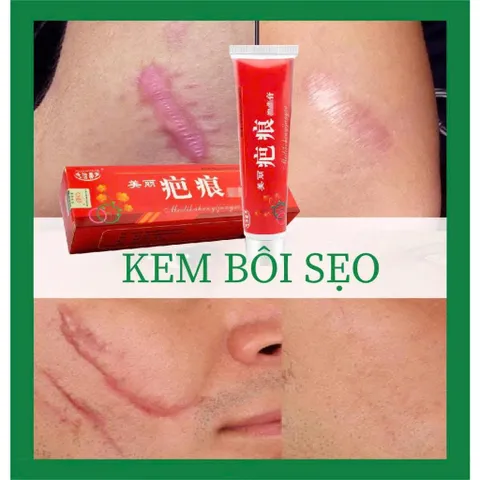 Kem bôi sẹo thảo mộc 60g - cực hiệu quả 834212