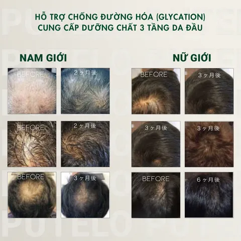 Dầu Xả – Ủ hỗ trợ giảm rụng tóc, cấp ẩm, chăm sóc 3 tầng da đầu PUTELO Hair Scalp Pack từ NHẬT 240g