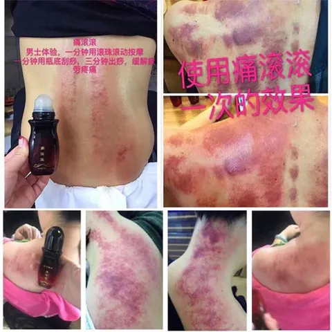 Dầu cạo gió đả thông kinh lạc CỔN CỔN THÔNG. Cạo gió giảm đau nhức toàn thân dùng trong dưỡng sinh