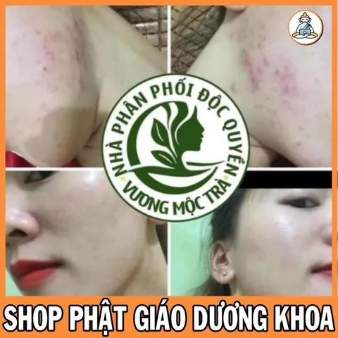 Combo một bộ sản phẩm vương mộc trà gồm bột rửa mặt và kem face tạo da cho da yếu 841805