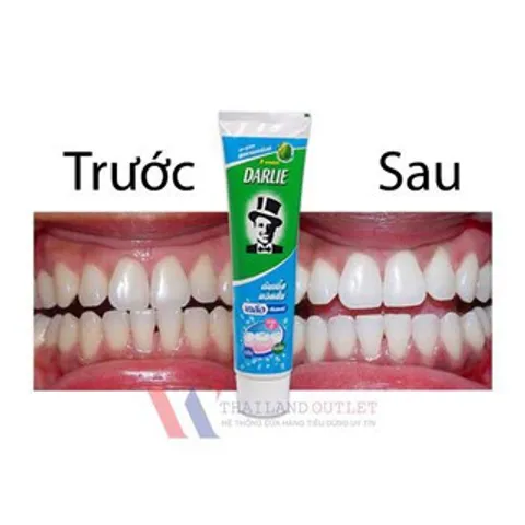 Kem đánh răng Tây Trà - Nụ cười trắng sáng tự nhiên, Bí quyết cho hàm răng trắng sáng khỏe mạnh, Bảo vệ răng miệng