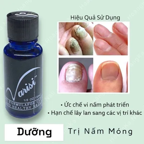 Dung dịch loại bỏ nấm móng Varisi hỗ trợ trị nấm móng nhanh chóng chuyên dụng ngành nail